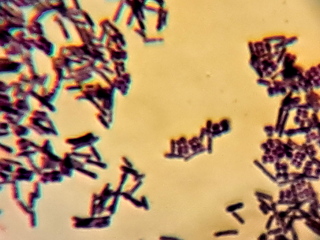 Balancing the Gut Microbiome: How KOSMOFERMENT Supports Natural Disease Resistance in Animals